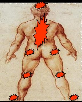 Douleurs mécaniques de l'axe du corps Podologue, podologie, posture, posturologie, sport, podologue du sport, équilibre, biomécanique, bilan postural, bilan podologique, semelles orthopédiques, semelles posturales, orthèses plantaires, mal de dos, lombalgie, cervicalgie, maux de tête, arthrose, arthrite, tendinite, TFL, patte d’oie, épine calcanéenne, myo-aponévrosite, hallux valgus, hallux rigidus, griffes d’orteil, Morton, cors, durillons, scoliose, fibromyalgie, instabilité, vertiges, ostéopathie, Essonne, Vigneux, Paris.